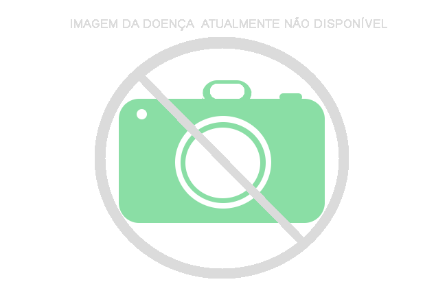 Imagem de Aviso Sobre Falta de Imagens